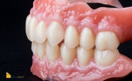 Composite 12