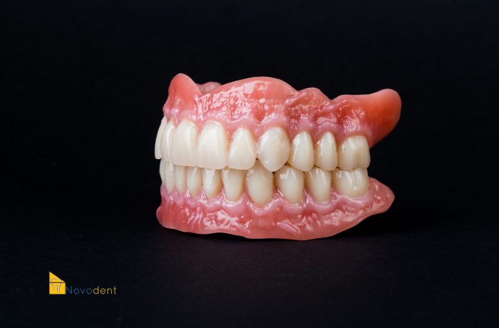 Composite