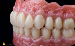 Composite 3