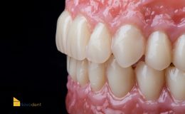 Composite 4
