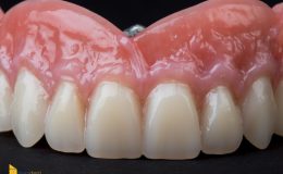 Composite 8