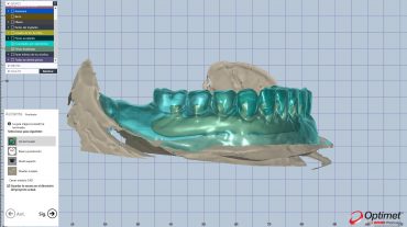 Casos cad-cam