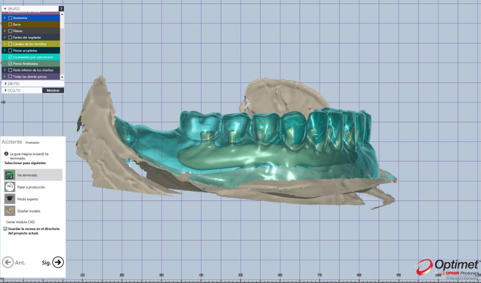 Casos cad-cam