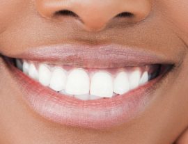 Fusce Euismod Consequat Ante