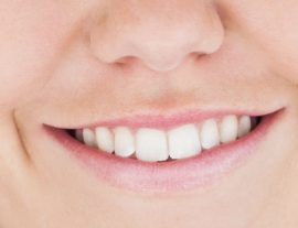 Mauris Accumsan Nulla Ve